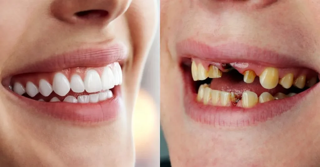 Regular Dental Visits