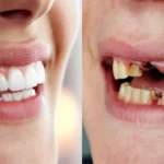 Regular Dental Visits